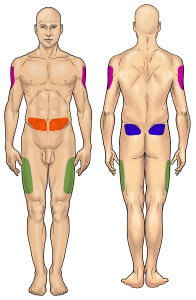 Siti per iniezione di insulina